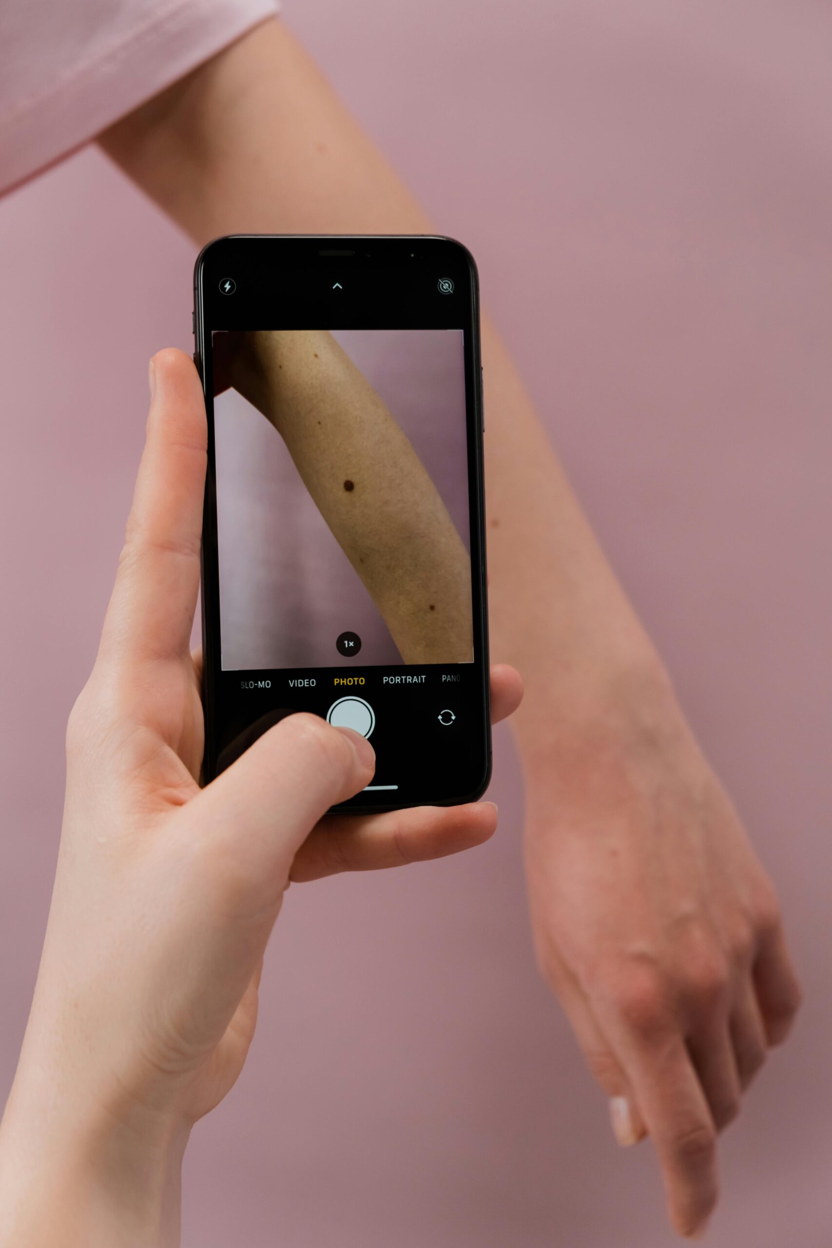 Close-up of a person examining a mole with a smartphone camera on a pink background.